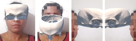 Four frames from the face-tracking application, showing a 3D skull model derived from CT data superimposed on a user's face and tracking it from several angles.