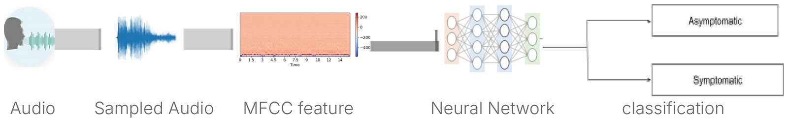 Block diagram of the TB screening pipeline: audio, sampled audio, MFCC feature extraction, neural network, then classification as asymptomatic or symptomatic.